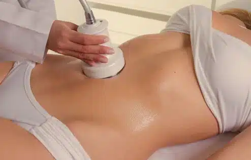 lipocavisation
