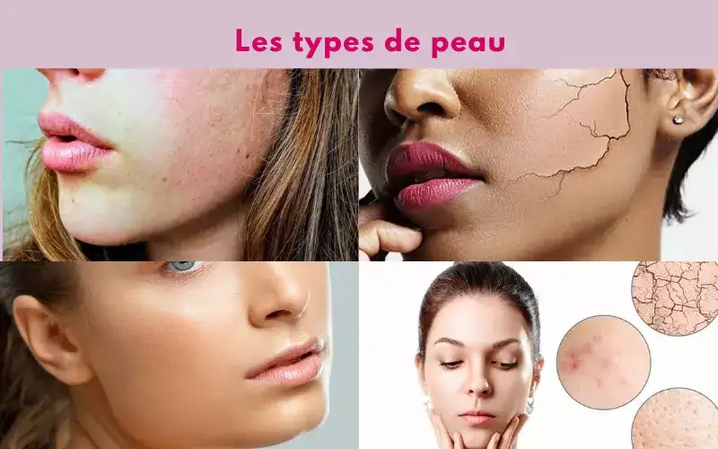 Les types de peau 1 image article 58.jpg