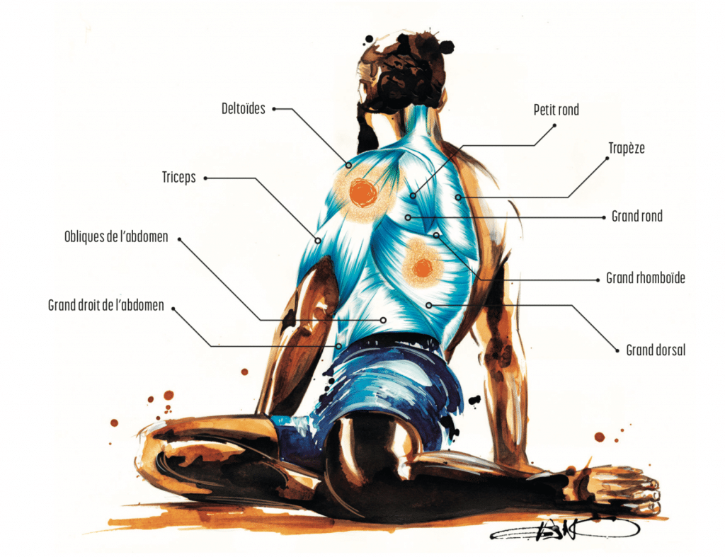 Fasciatherapie 1 trigger point deux sevres 1024x787 1